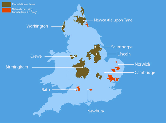 Areas of England with fluoride in the water